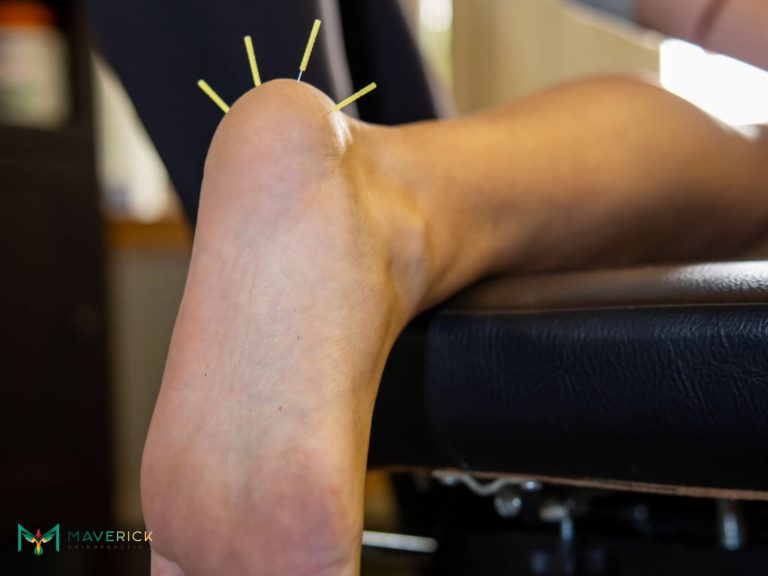can a chiropractor help with achilles tendonitis